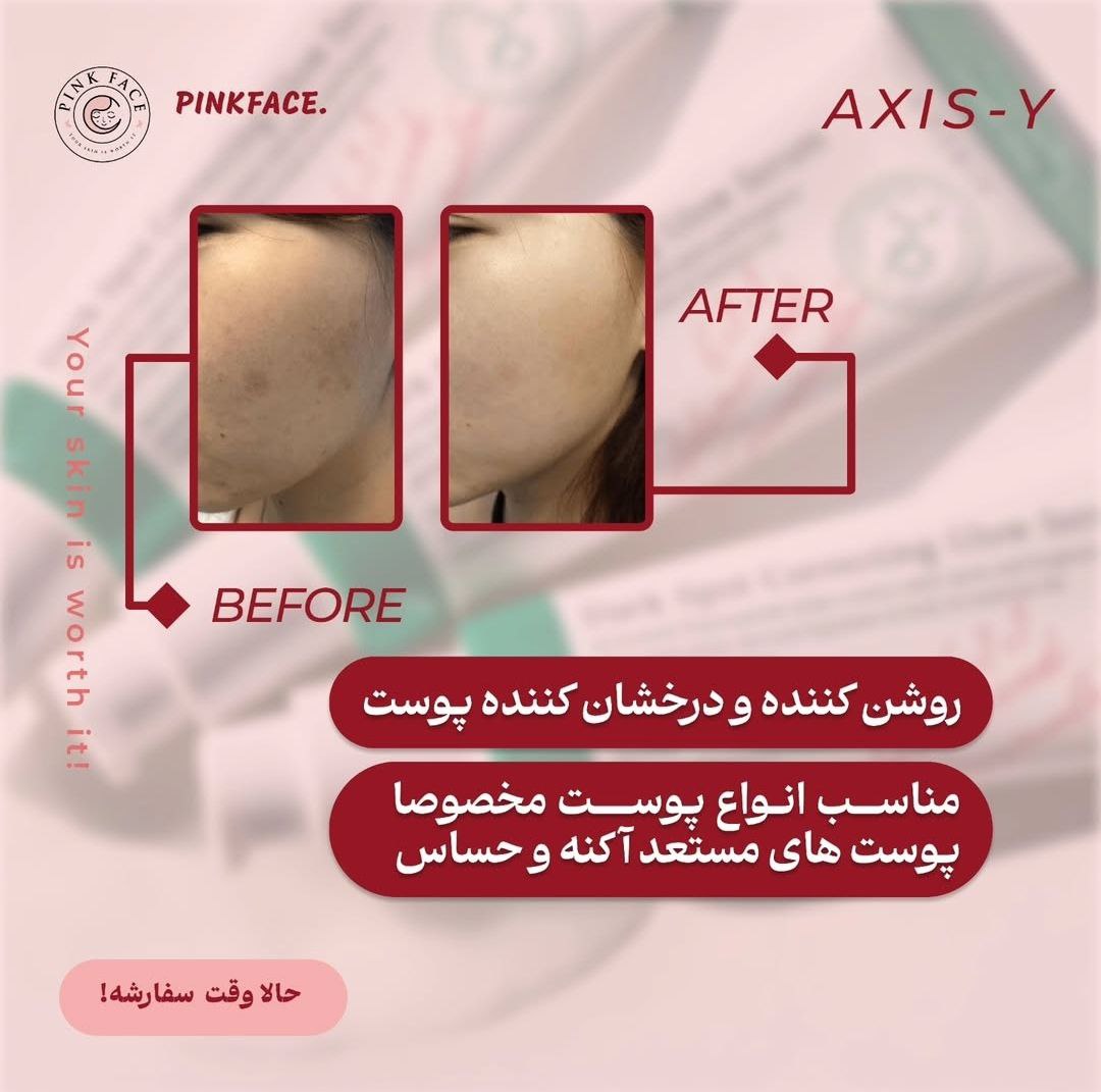 ضد لک اکسیس وای 4